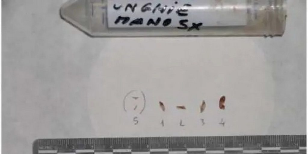 unghie mano sx perizie genetiche