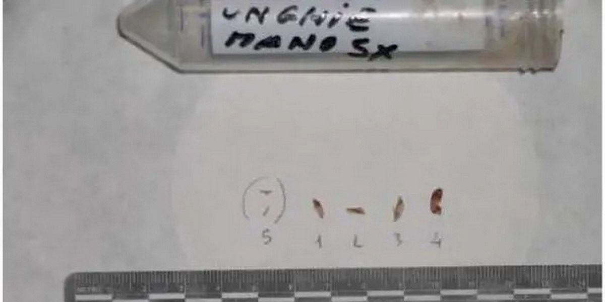 unghie mano sx perizie genetiche